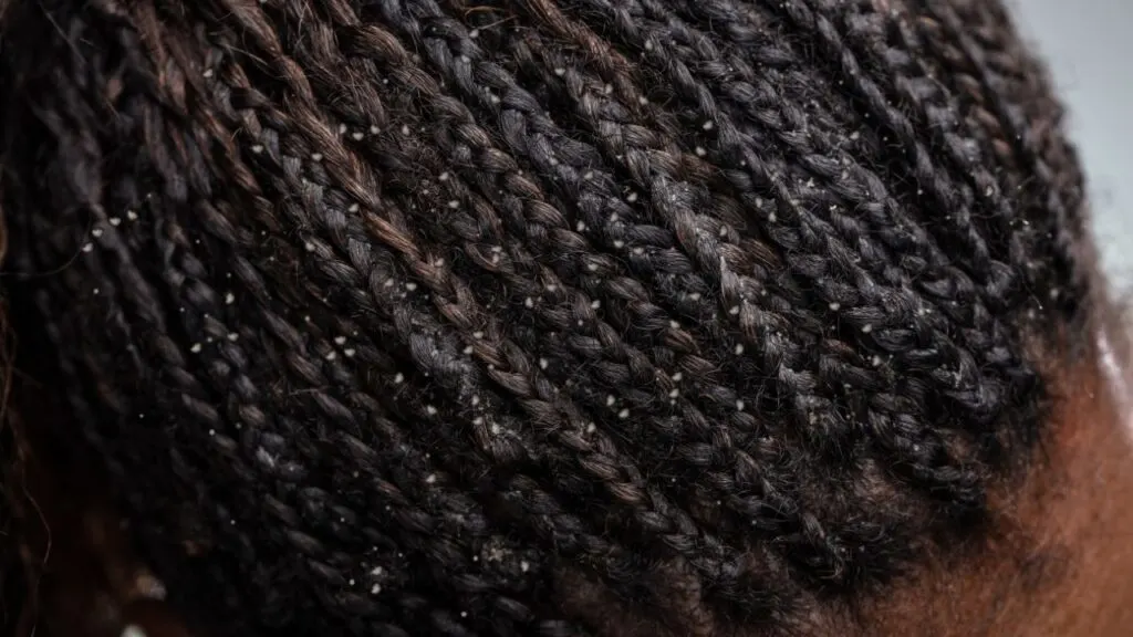 dandruff shampoo for 4c hair